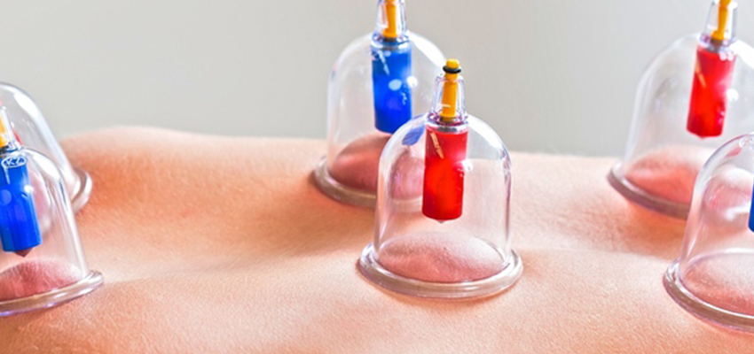 "Hijama Cupping Auricular Therapy Cosmetic Acupuncture"